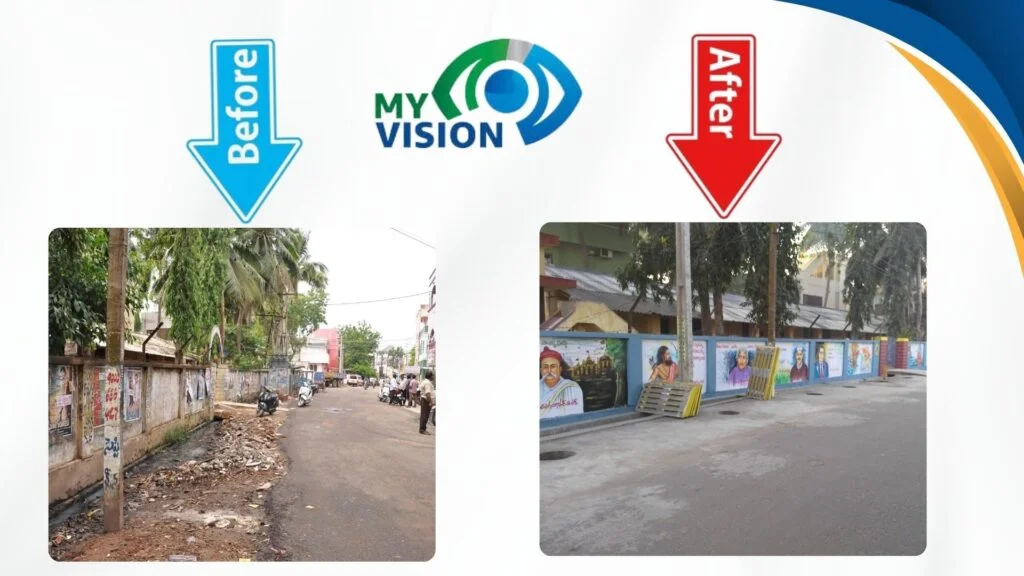 My Vison , Before & After